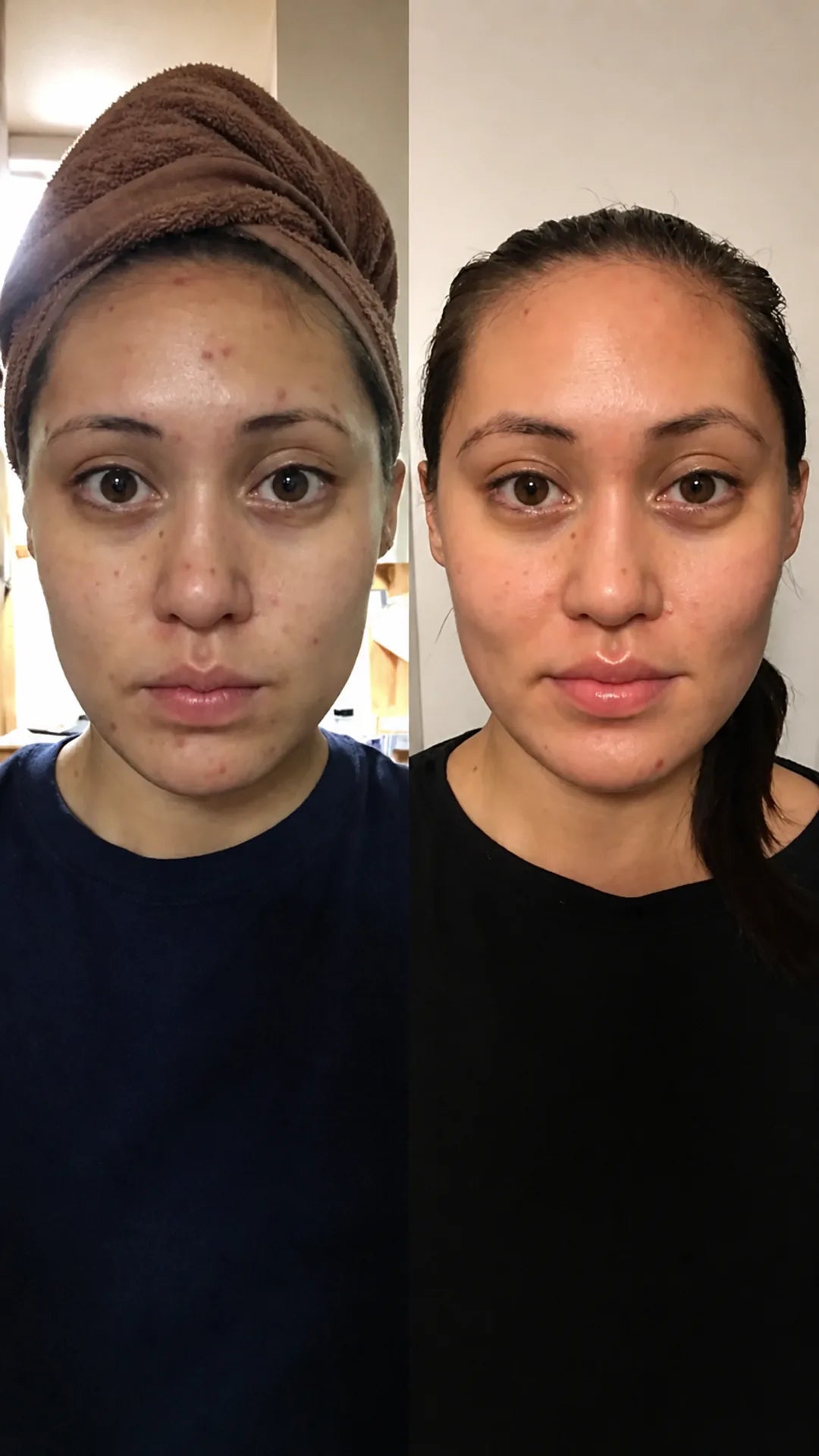 Comparación frontal de textura visible en el rostro