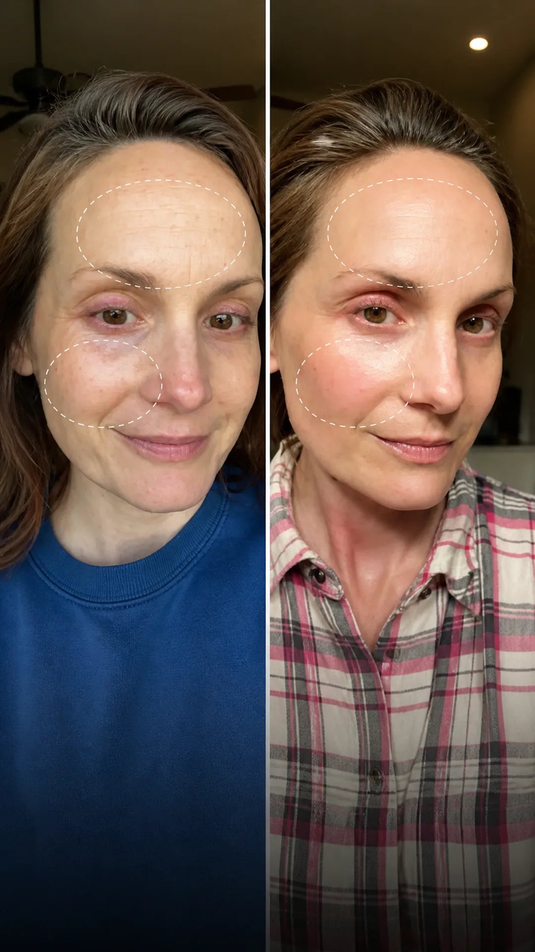 Comparación de líneas y textura facial