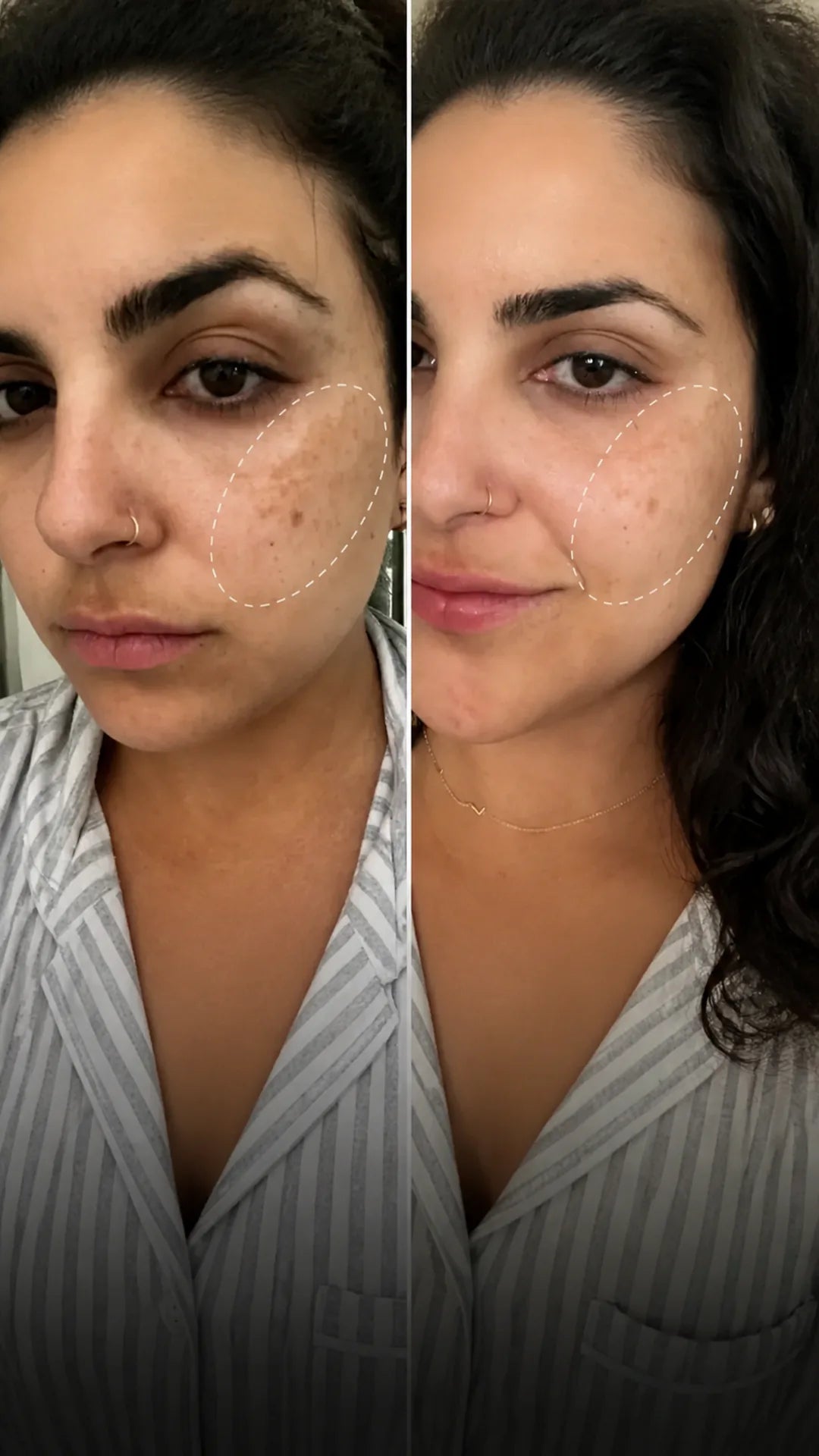 Comparación visual de manchas en la piel