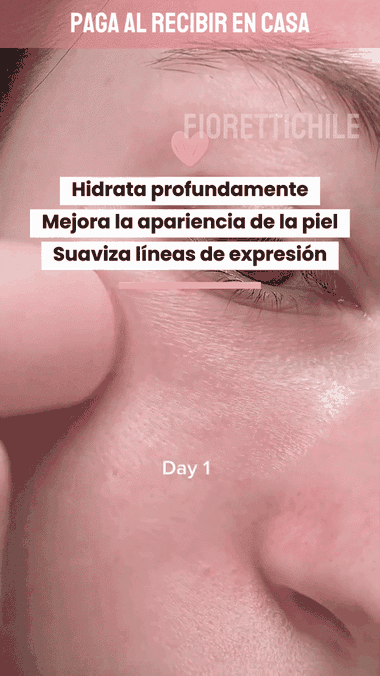 Primer plano de las zonas donde la piel se seca
